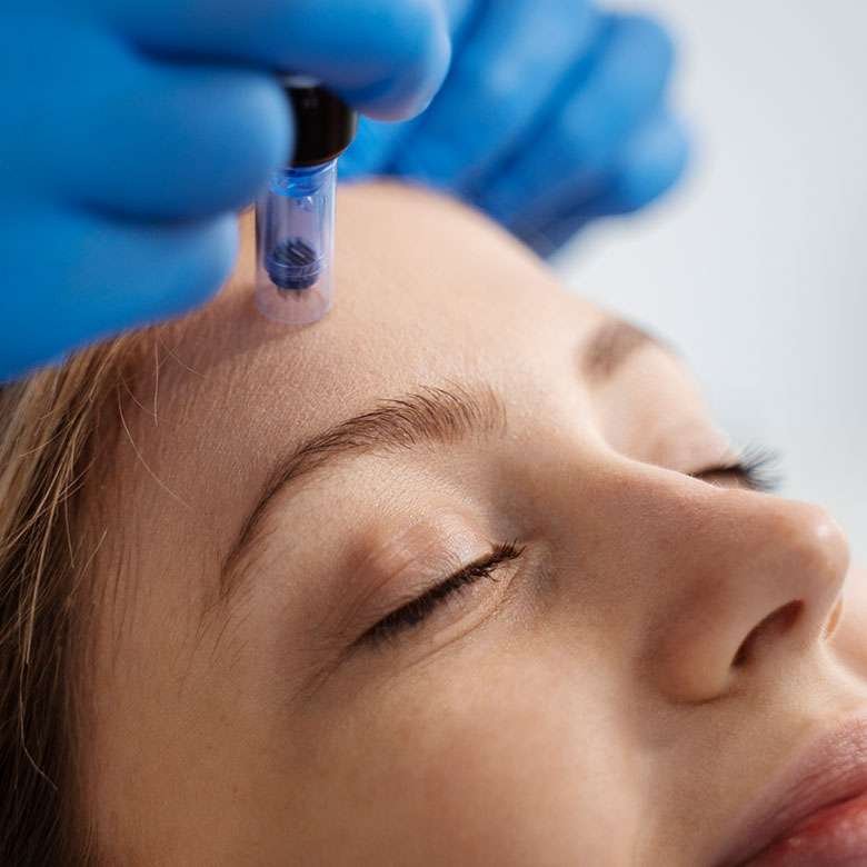 Plasma Rico en Plaquetas 2 PLASMA RICO EN PLAQUETAS antiaging 2